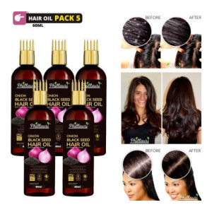 Phillauri Onion Oil for Hair Regrowth Aryuvedic Hair Oil (PACK 5) Hair Oil  (300 ml)